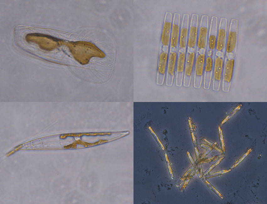Examples of the microscopic plants found within sea ice. Photos: © Vanessa Pitusi. 